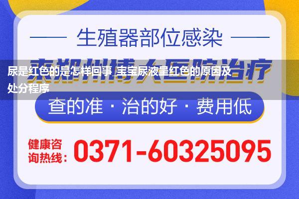 尿是红色的是怎样回事_宝宝尿液呈红色的原因及处分程序